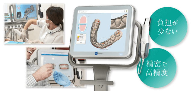 負担が少ない 精密で高精度